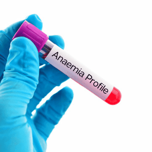 Anaemia Blood test Profile tube image for a kit MBMD