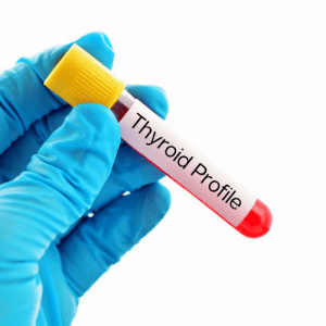 Thyroid Home test kit uk tube image MBMD