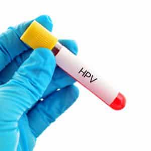 HPV Test. Variant type Men & women testing Kit home MBMD