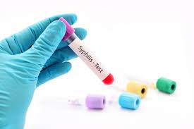 Syphilis home test kit blood test MBMD