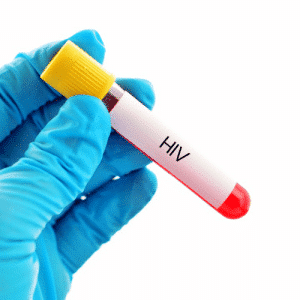 HIV blood home test kit MBMD