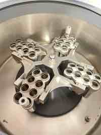 My mother died from OC when I was seventeen MBMD