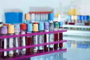 Tiredness, lightheaded, dehydration, metallic taste MBMD