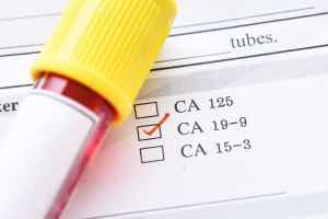 Pain, it takes your breath away and you die from it? MBMD